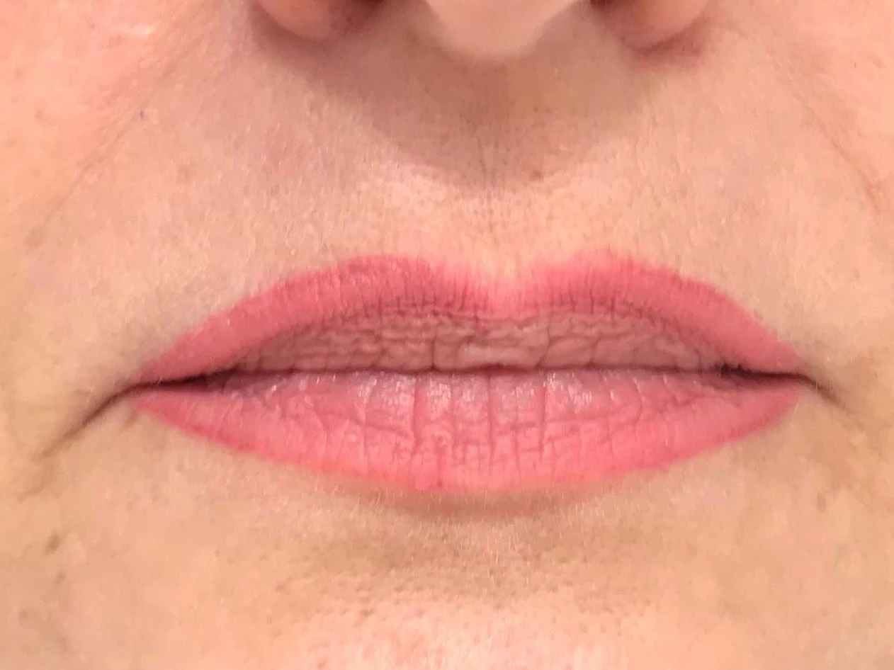 Antes - Micropigmentación de labios