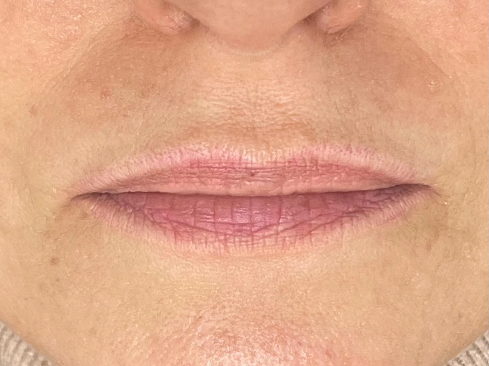 Después - Micropigmentación de labios