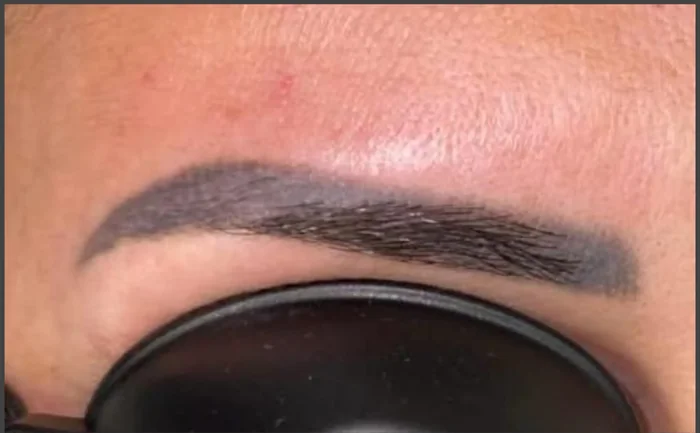 Antes - Eliminación de Microblading