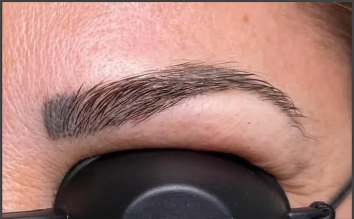 Antes - Eliminación de Microblading