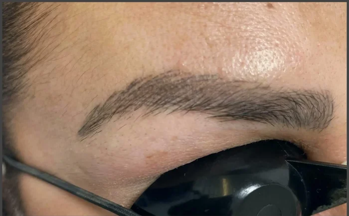 Antes - Eliminación de Microblading
