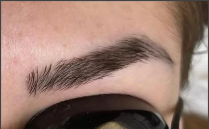 Antes - Eliminación de Microblading