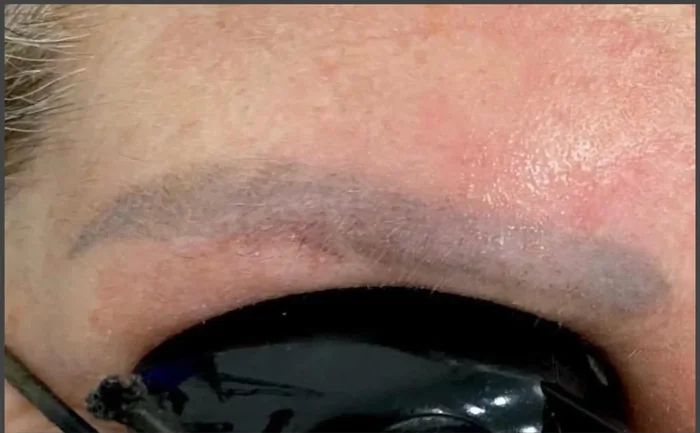 Antes - Eliminación de Microblading