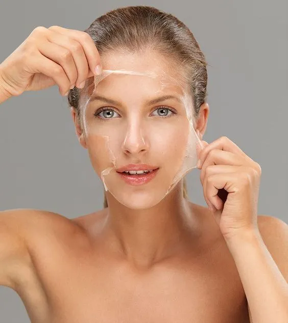 Peeling Químico