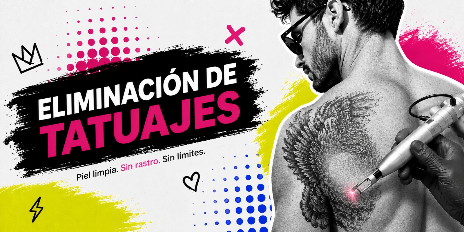 Eliminación de Tatuajes Piel Zero