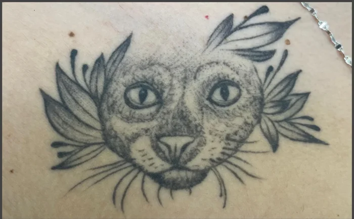 Antes - Eliminación de Tatuajes