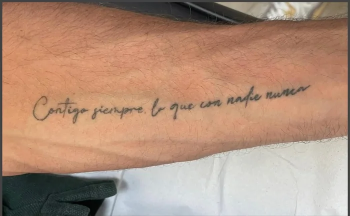 Antes - Eliminación de Tatuajes