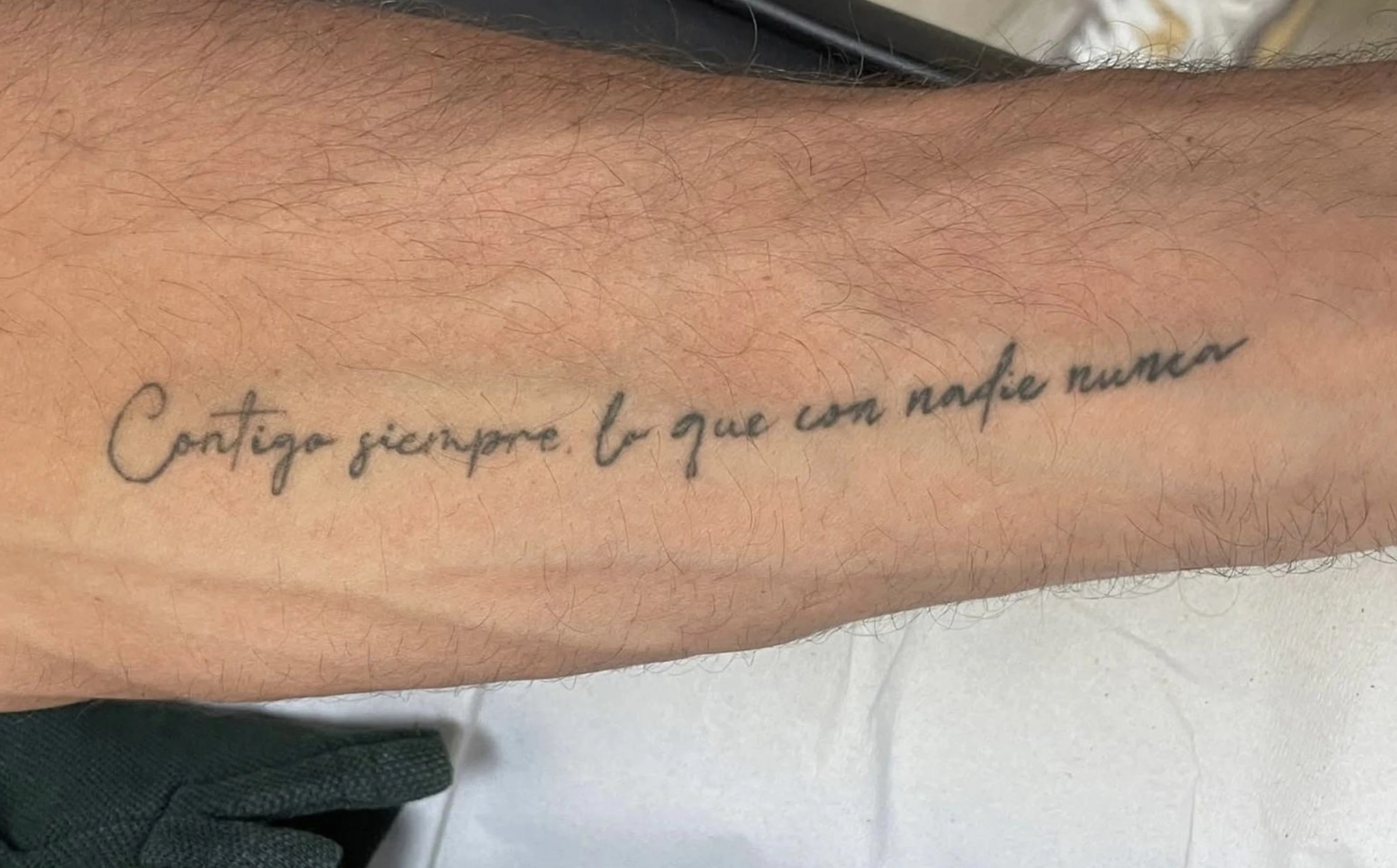 Antes - Eliminación de Tatuajes